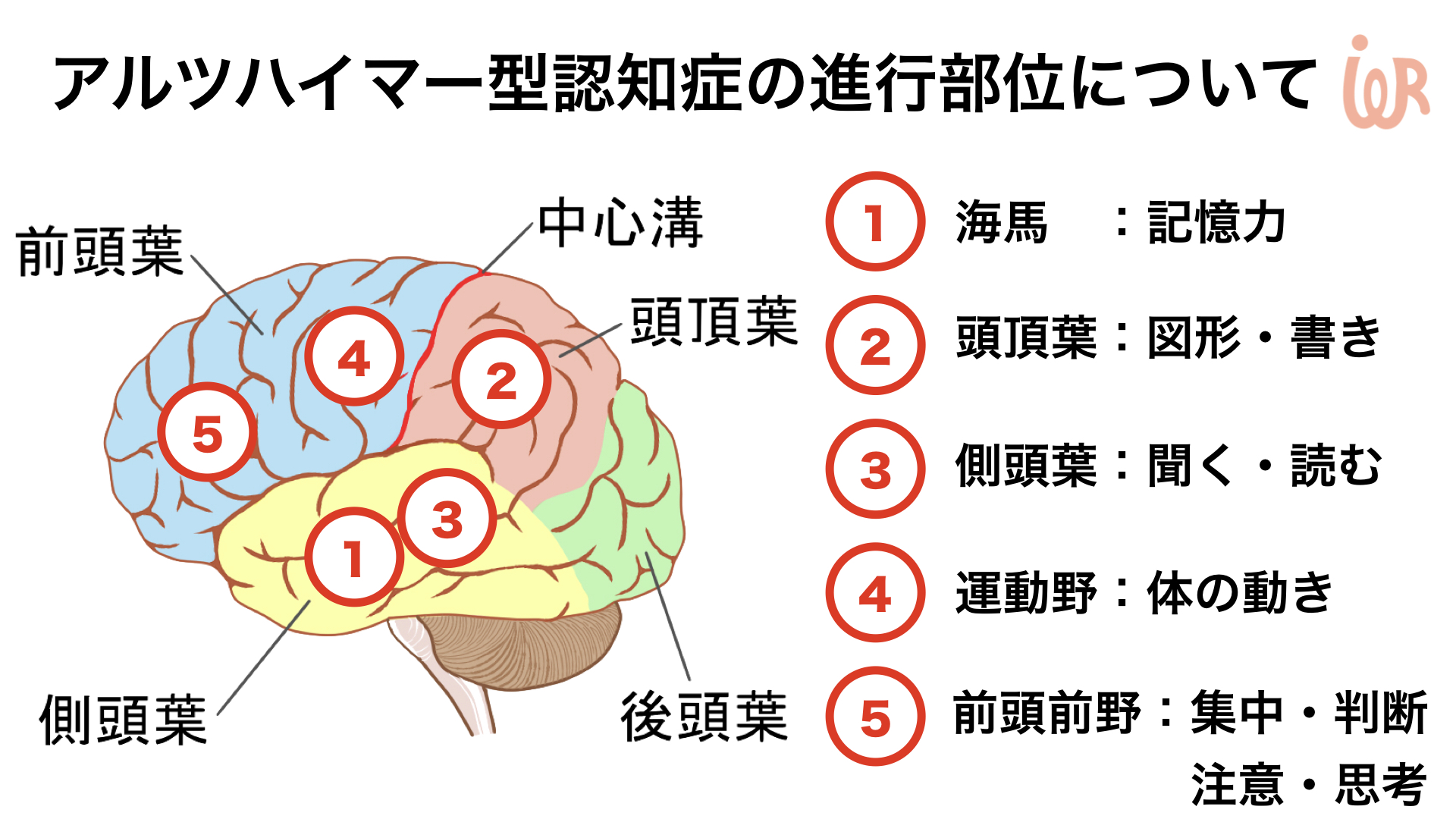 ウェルニッケ・コルサコフ症候群